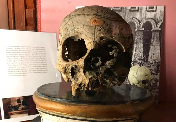 Неаполь Museo Universitario delle Scienze e delle Arti Cranio Umano